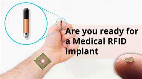 rfid chip in eye lazer|Human Microchipping: An Unbiased Look at the Pros and Cons.